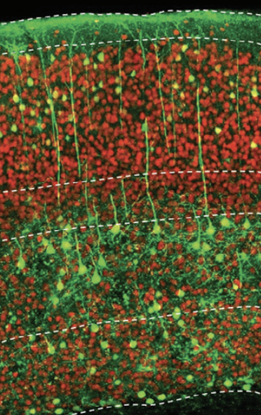 Advanced Science 2025 Apr;12(14):e2410080. doi: 10.1002/advs.202410080.